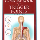 The Concise Book of Trigger Points 2th 2008